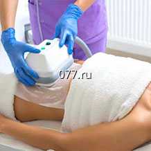 похудение (коррекция фигуры, снижение веса) метод-криолиполиз