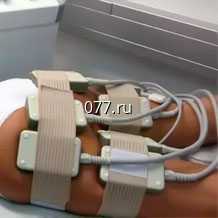 похудение (коррекция фигуры, снижение веса) метод-лазерный липолиз (липолазер), миостимуляция (электростимуляция)