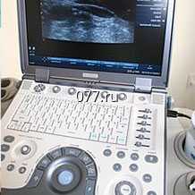 ультразвуковое исследование (УЗИ) исследуемые органы-суставы (коленный, тазобедренный, голеностопный, плечевой, локтевой, кистей рук)