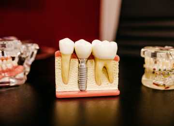 Воронежские стоматологи вылечили более миллиона зубов в прошлом году 